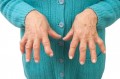 Healthy Aging: Arthritis Awareness Month