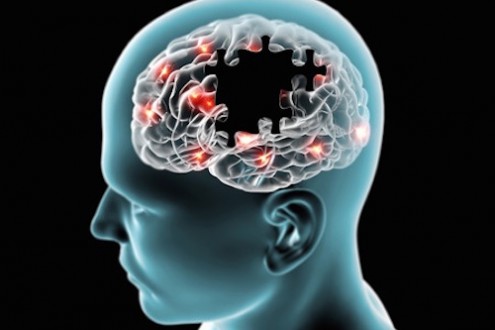 Can Statins Cause Brain Decline?