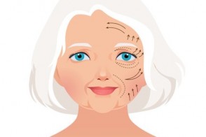 Aesthetic Surgery for Women 60 & Older: What's the Risk?