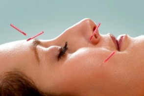 Pinpointing Cosmetic Acupuncture