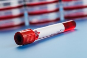 Ovarian Cancer & Genetic Testing