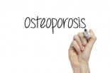Ask Dr. Mike: Osteoporosis Prevention &amp; Virus Help