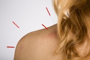 Acupuncture for Hot Flashes in Women with Breast Cancer