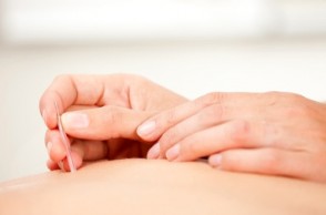 Menopausal? Acupuncture Can Treat Your Hot Flashes