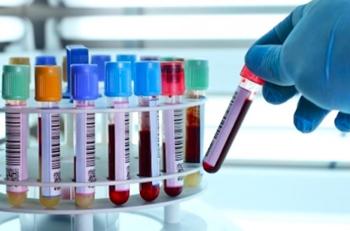 New Blood Test Can Confirm IBS