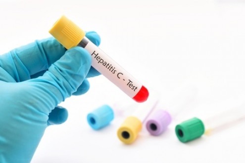 Hepatitis C Prevalence &amp; Risk