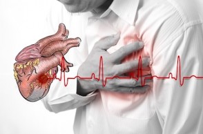 Coronary Heart Disease Myths & Facts