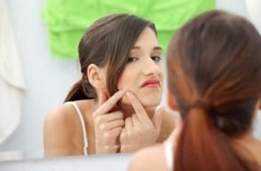 5 Holistic Ways to Treat Acne 