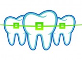 Adult Braces vs. Invisalign: What's Right for You?