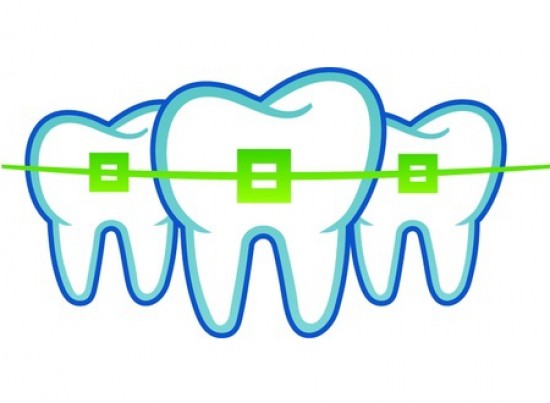 Adult Braces vs. Invisalign: What&#039;s Right for You?