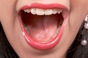 What Does Your Saliva Say About Your Health?