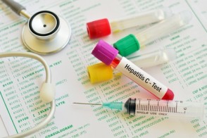 Overcoming Hepatitis C