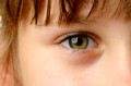 Eye Health: Your Child's Eyes Need Your Attention