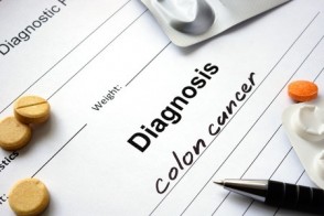 Colon Cancer on the Rise in Young Adults