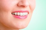 Braces? Expanders? Keeping Your Teen&#039;s Teeth Healthy